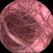 Urethral Hair
