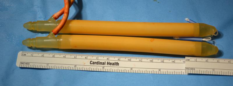 Unexpanded Cylinders