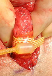 AUS Cuff